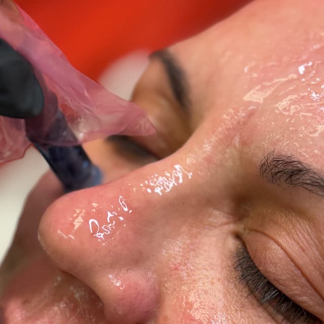 3 Microneedle Sessions at Marissa - Aesthetic Nurse in Alice, TX